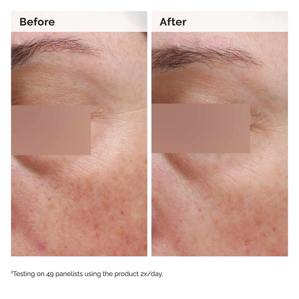 niacinamide-5-face-and-body-emulsion-j4 2024-08-23-ORD-Nia-5pct-Face-Body-B-A-Elasticity-Global-02-1x1.jpg