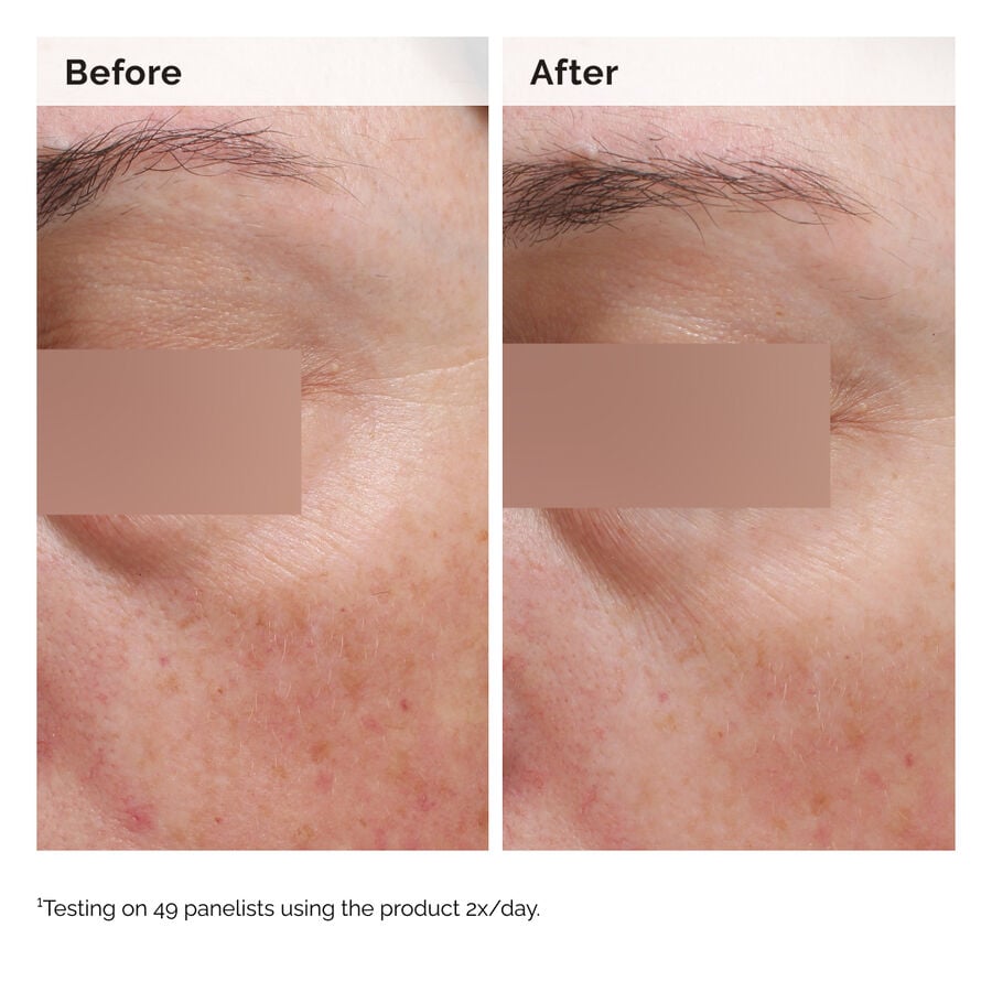 niacinamide-5-face-and-body-emulsion-l8 2024-08-23-ORD-Nia-5pct-Face-Body-B-A-Elasticity-Global-02-1x1.jpg