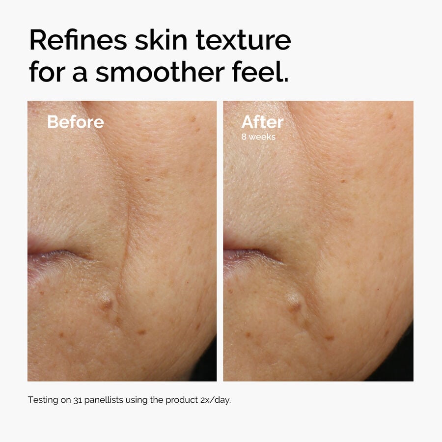 caffeine-3-escin-1-face-serum-j8 ord-caffeine-3pct-escin-1pct-face-serum-before-after-texture.jpg