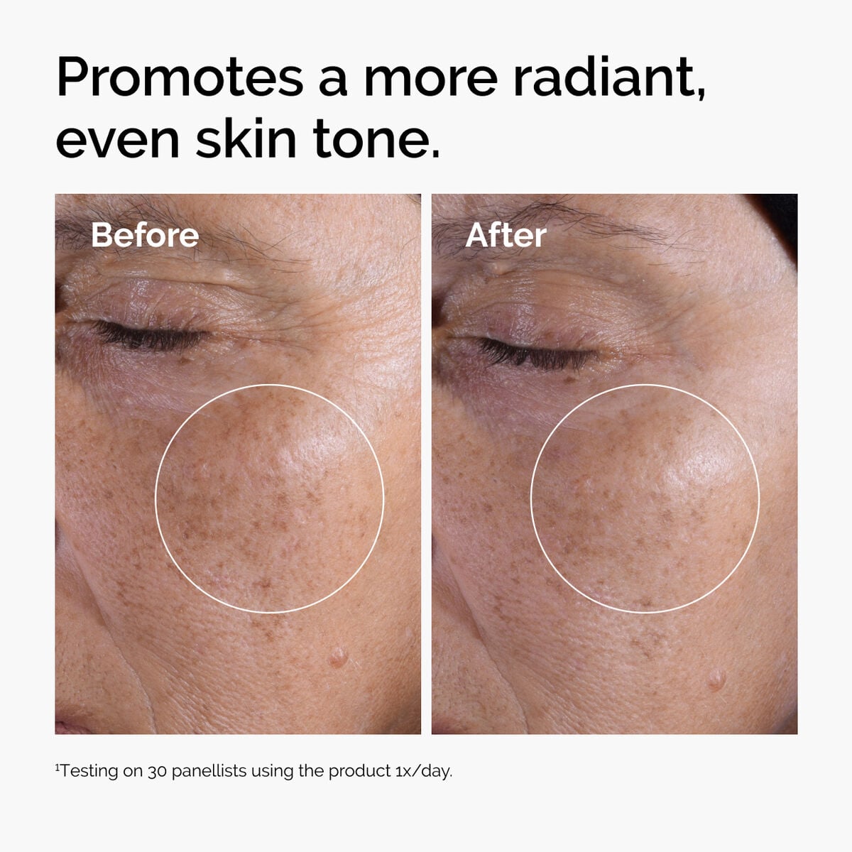 glycolic-acid-7-exfoliating-toner-y2 ord-glycolic-before-after-radiance.jpg