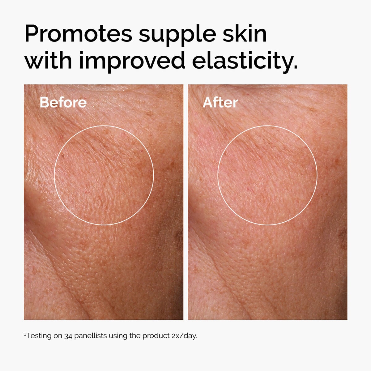 hyaluronic-acid-2-b5-with-ceramides-l6 ord-hyaluronic-acid-2pct-b5-hydrating-serum-before-after-elasticity.jpg