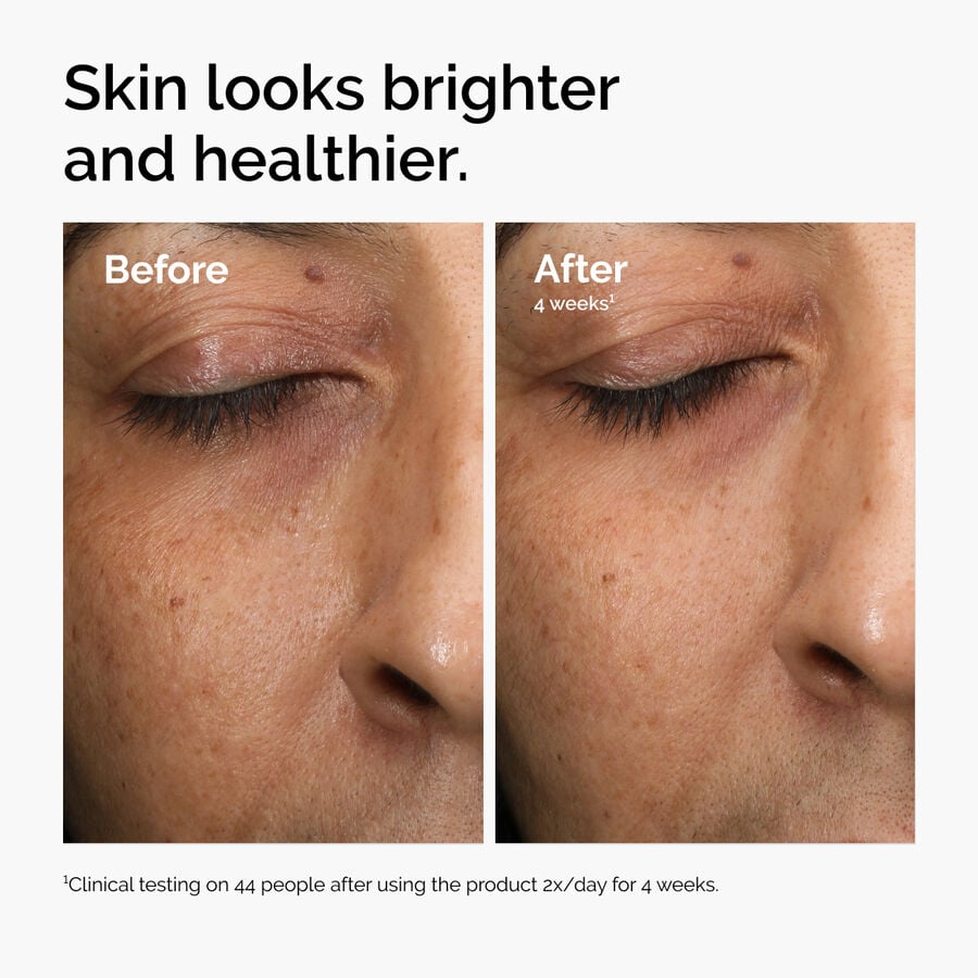 multi-antioxidant-radiance-serum-r0 ord-mars-before-after-healthy.jpg