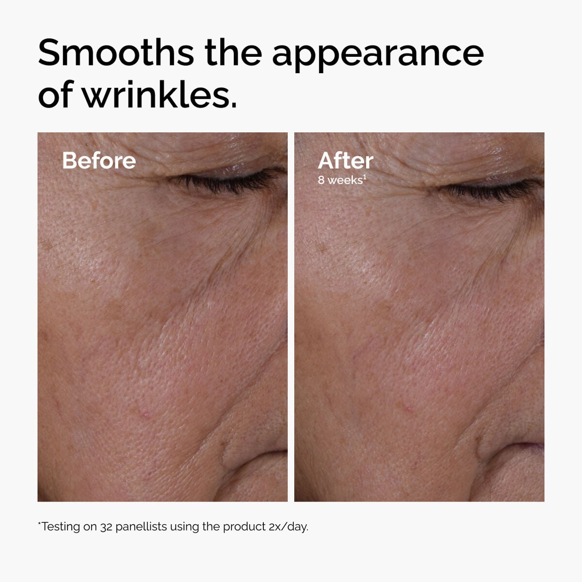 multi-peptide-ha-serum-a4 ord-multi-peptide-ha-serum-wrinkles-before-after.jpg