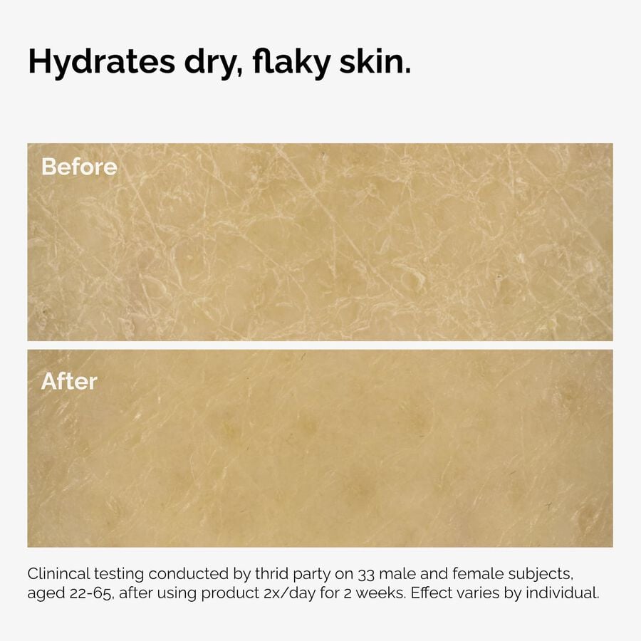 the-body-care-collection-d7 ord-natural-moisturizing-factors-inulin-body-before-after-graphic-02.jpg