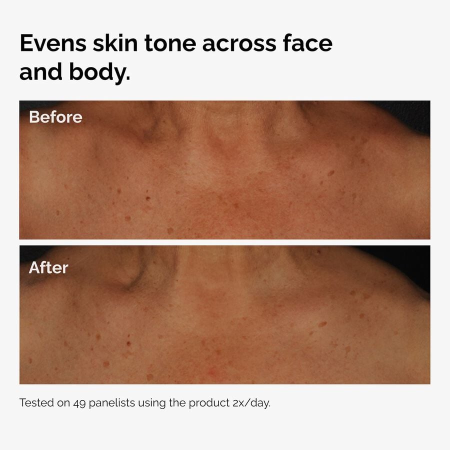 the-body-care-collection-d7 ord-niacinamide-face-body-serum-before-after-even-tone-graphic.jpg