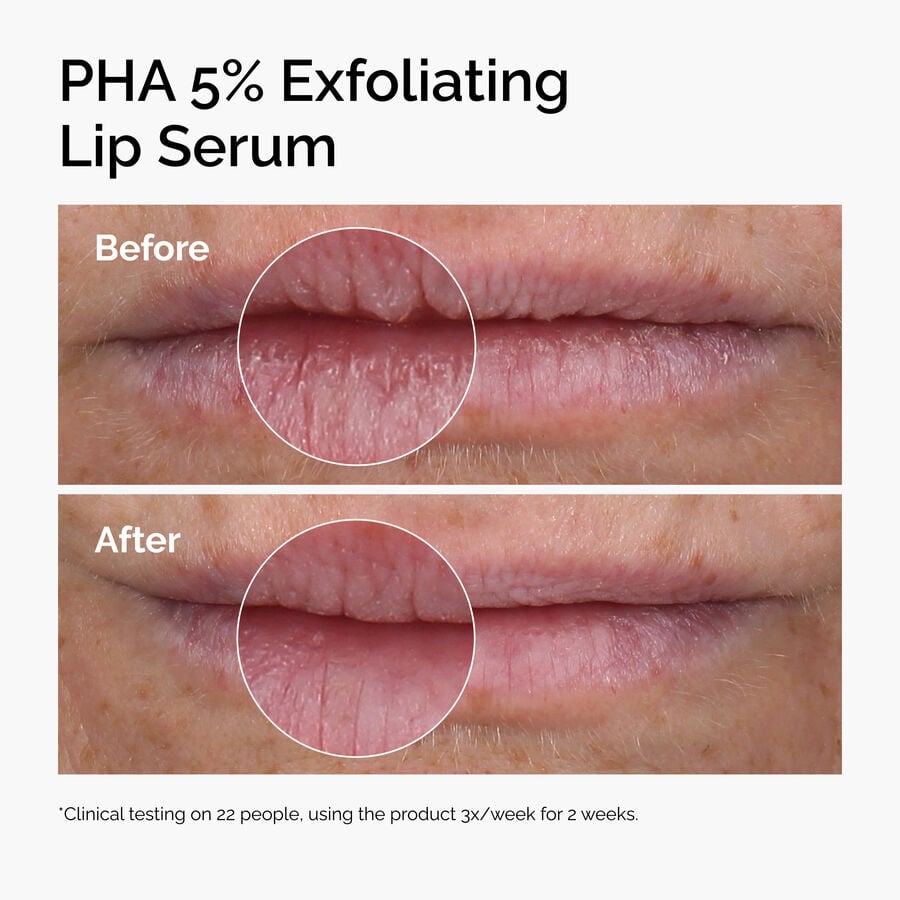 pha-5-exfoliating-lip-serum-s4 ord-pha-5pct-lip-exfoliating-serum-before-after.jpg